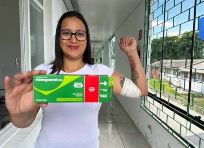 Implante contraceptivo de até R$4 mil chega gratuitamente ao SUS de Foz